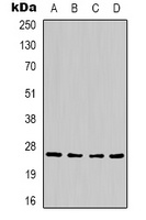 HSP27 Rabbit Polyclonal Antibody