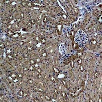 HSP27 Rabbit Polyclonal Antibody