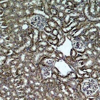 HSP60 Rabbit Polyclonal Antibody