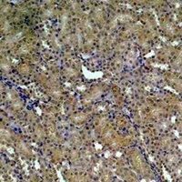 HSP90 alpha Rabbit Polyclonal Antibody