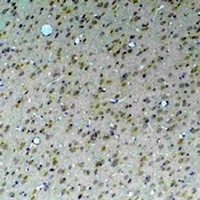 KCNN4 Rabbit Polyclonal Antibody