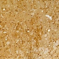 Kv1.1 Rabbit Polyclonal Antibody