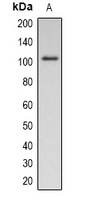 Pepsinogen C (Phospho-S15) Rabbit Polyclonal Antibody