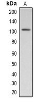 Pepsinogen C Rabbit Polyclonal Antibody