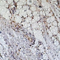 Peroxiredoxin 1 Rabbit Polyclonal Antibody