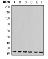 SOD2 Rabbit Polyclonal Antibody