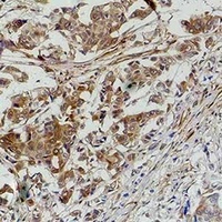 STAT1 Rabbit Polyclonal Antibody
