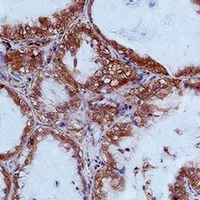 STAT2 Rabbit Polyclonal Antibody