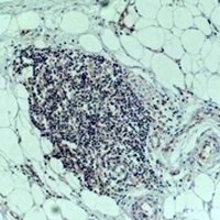 TNF alpha Rabbit Polyclonal Antibody