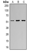 Vimentin Rabbit Polyclonal Antibody