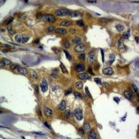 Vimentin Rabbit Polyclonal Antibody