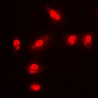 FOXO1 (Phospho-S256) Rabbit Polyclonal Antibody