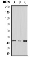 HSD3B2 Rabbit Polyclonal Antibody