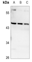 VPS4B Rabbit Polyclonal Antibody