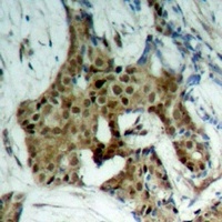 STAT1 (Phospho-Y701) Rabbit Polyclonal Antibody