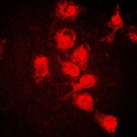 STAT1 (Phospho-Y701) Rabbit Polyclonal Antibody