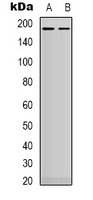 HER2 Rabbit Polyclonal Antibody