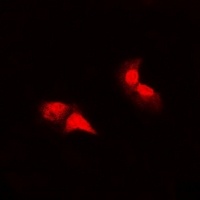 HER2 Rabbit Polyclonal Antibody