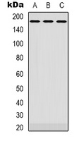 EGFR Rabbit Polyclonal Antibody