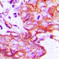 EGFR Rabbit Polyclonal Antibody