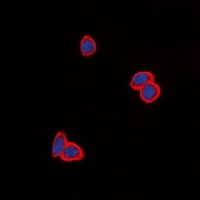 EGFR Rabbit Polyclonal Antibody