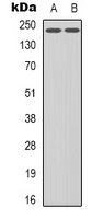 VEGFR2 (Phospho-Y1214) Rabbit Polyclonal Antibody