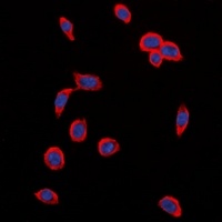 VEGFR2 (Phospho-Y1214) Rabbit Polyclonal Antibody
