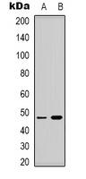Lupus La (Phospho-S366) Rabbit Polyclonal Antibody