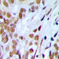Lupus La (Phospho-S366) Rabbit Polyclonal Antibody