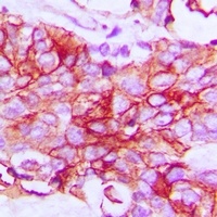 IFNGR1 Rabbit Polyclonal Antibody