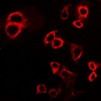 IFNGR1 Rabbit Polyclonal Antibody