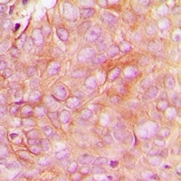 STMN1 (Phospho-S16) Rabbit Polyclonal Antibody