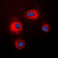 STMN1 (Phospho-S16) Rabbit Polyclonal Antibody