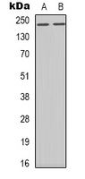 BRCA1 (Phospho-S1423) Rabbit Polyclonal Antibody
