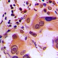 BRCA1 (Phospho-S1423) Rabbit Polyclonal Antibody