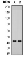 JUND (Phospho-S255) Rabbit Polyclonal Antibody