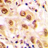 JUND (Phospho-S255) Rabbit Polyclonal Antibody