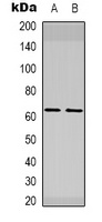 ELK1 Rabbit Polyclonal Antibody