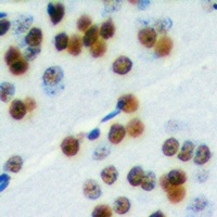 ELK1 Rabbit Polyclonal Antibody