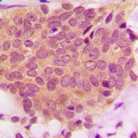 Ezrin/Radixin/Moesin Rabbit Polyclonal Antibody
