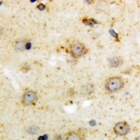 NTR1 Rabbit Polyclonal Antibody