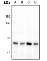 FAP alpha Rabbit Polyclonal Antibody