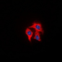 FAP alpha Rabbit Polyclonal Antibody