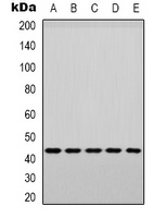 p38 (Phospho-Y182) Rabbit Polyclonal Antibody