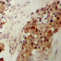 p38 (Phospho-Y182) Rabbit Polyclonal Antibody