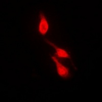 p38 (Phospho-Y182) Rabbit Polyclonal Antibody