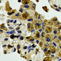 JNK1/2/3 Rabbit Polyclonal Antibody
