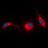 JNK1/2/3 Rabbit Polyclonal Antibody