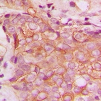 HER2 Rabbit Polyclonal Antibody