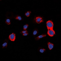 HER2 Rabbit Polyclonal Antibody